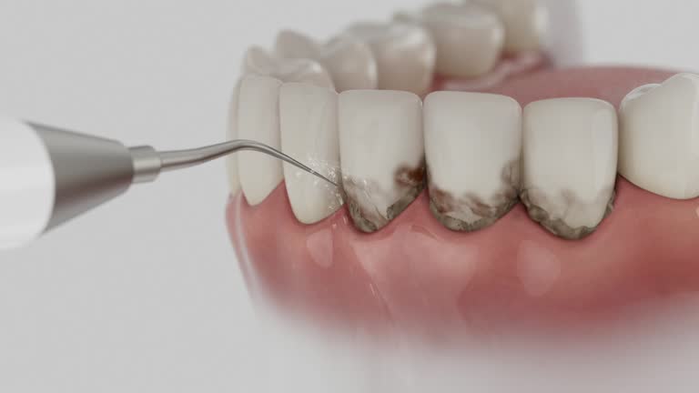 Trusted Tooth Extraction service in Rouse, CA - Dentist Open Now